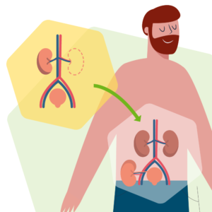 Eine Grafik zur Nierentransplantation beim Mann.