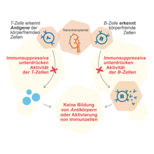 Eine Grafik, die erklärt, wie eine immunsuppressive Therapie funktioniert.