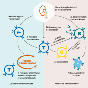 Eine Grafik, die erklärt, warum ein Nierentransplantat abgestoßen wird.