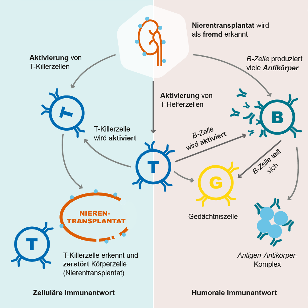 Transplant-Wissen > Medical > Transplantatabstoßung, Spenderorgan verlieren, Abstoßungsreaktion Transplantation, Abstoßung Spenderorgan