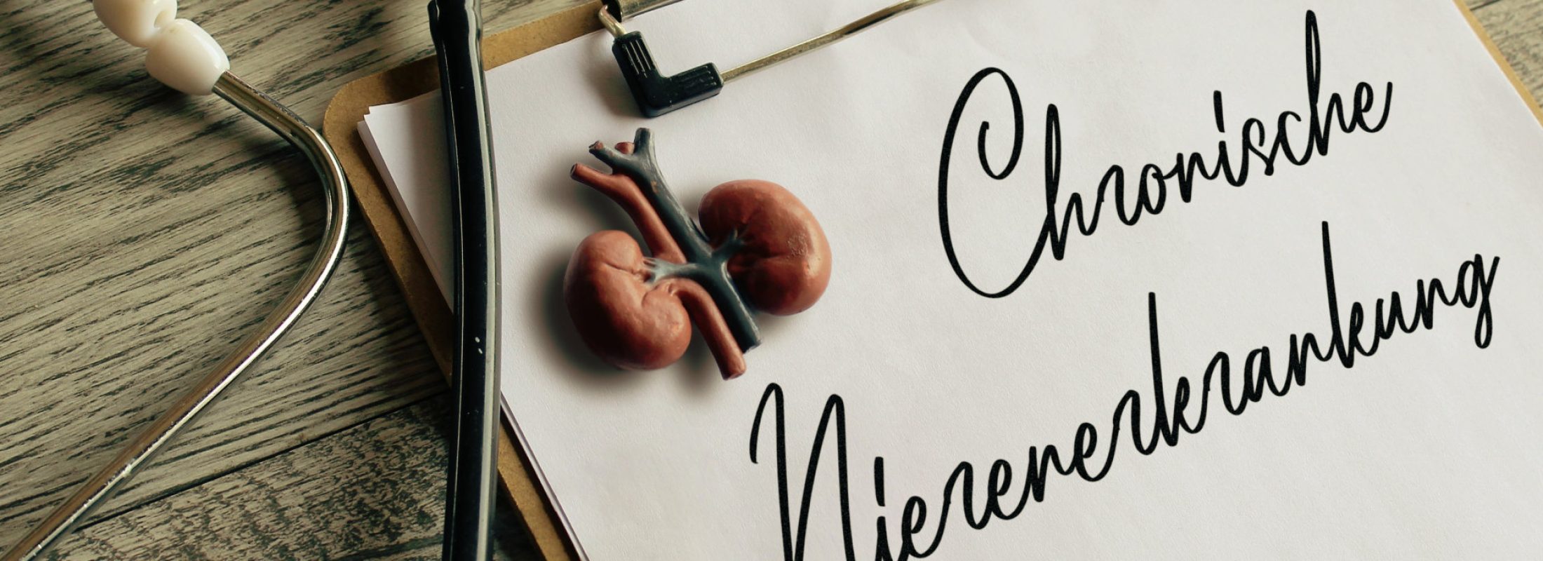 Ein Stethoskop liegt auf einem Klemmbrett, auf dem eine kleine Plastik der Nieren liegt und der Schriftzug Chronische Nierenerkrankung zu lesen ist. Es steht symbolisch dafür, dass viele Patientinnen und Patienten mit der Diagnose chronische Nierenerkrankung oder Niereninsuffizienz auf eine Nierenersatztherapie, das heißt eine Dialyse oder eine Nierentransplantation, angewiesen sind.